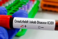 Entenda Doença de Creutzfeldt-Jakob, diagnóstico do piloto Lito Souza