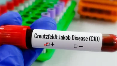 Entenda Doença de Creutzfeldt-Jakob, diagnóstico do piloto Lito Souza