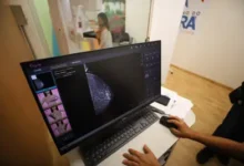 Mulheres realizando exame de mamografia no Hospital da Mulher em Belém durante campanha do Outubro Rosa