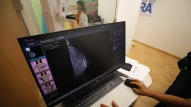 Mulheres realizando exame de mamografia no Hospital da Mulher em Belém durante campanha do Outubro Rosa