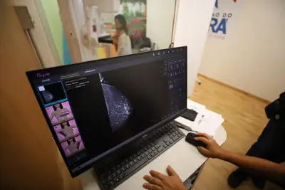 Mulheres realizando exame de mamografia no Hospital da Mulher em Belém durante campanha do Outubro Rosa